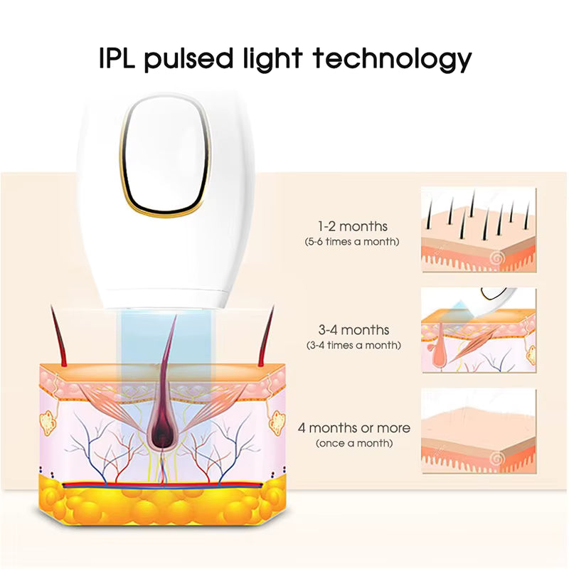 DEPILADORA LASER IPL